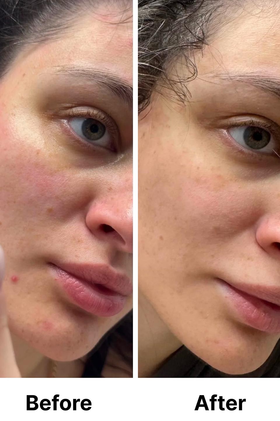 Brightening Hyper C Serum - IIRA